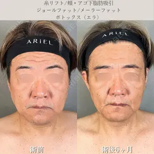 アリエル美容クリニック 水戸院 天白 典秀医師の症例