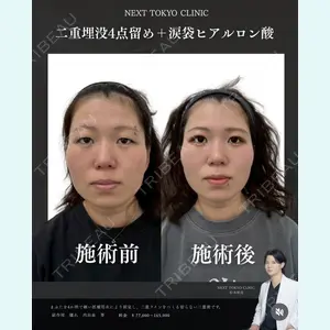 症例