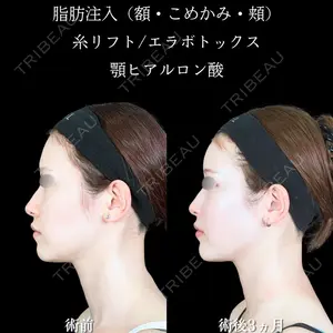 アリエル美容クリニック 大宮院 鈴木　桂介医師の症例