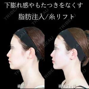 アリエル美容クリニック 大宮院 鈴木　桂介医師の症例