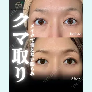 小倉美容外科/美容皮膚科 ビラビューティークリニック 大村 亞蘭医師の症例