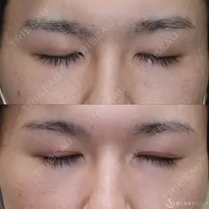 聖心美容クリニック 名古屋院 加藤 大典医師の症例