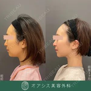 オアシス美容外科 遠藤 剛史医師の症例