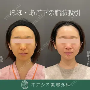 オアシス美容外科 遠藤 剛史医師の症例