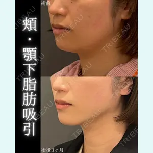 オアシス美容外科 遠藤 剛史医師の症例