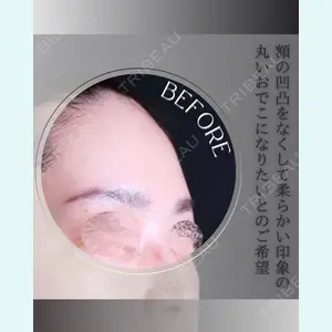 小倉美容外科/美容皮膚科 ビラビューティークリニック 大村 亞蘭医師の症例