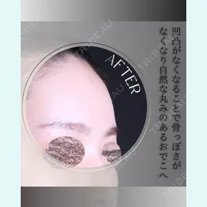 小倉美容外科/美容皮膚科 ビラビューティークリニック 大村 亞蘭医師の症例