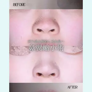 小倉美容外科/美容皮膚科 ビラビューティークリニック 大村 亞蘭医師の症例