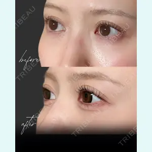 小倉美容外科/美容皮膚科 ビラビューティークリニック 大村 亞蘭医師の症例