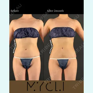 MYCLI【マイクリ】大阪・梅田院 三木 晶森医師の症例