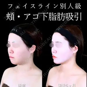 アリエル美容クリニック 水戸院 天白 典秀医師の症例