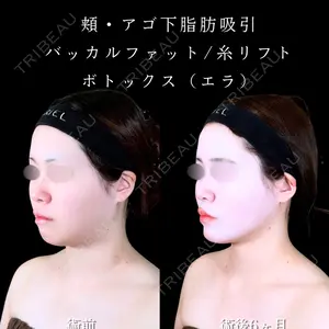 アリエル美容クリニック 水戸院 天白 典秀医師の症例