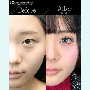 Leap beauty clinic 土門 駿也医師の症例