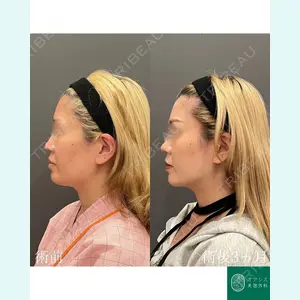 オアシス美容外科 遠藤 剛史医師の症例