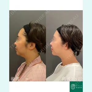 オアシス美容外科 遠藤 剛史医師の症例