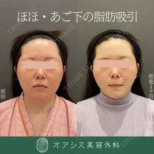 オアシス美容外科 遠藤 剛史医師の症例