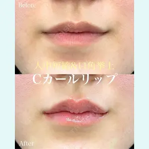 ルラ美容クリニック 名古屋本院 山本 美佳医師の症例