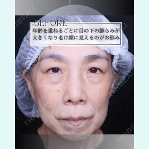 小倉美容外科/美容皮膚科 ビラビューティークリニック 大村 亞蘭医師の症例