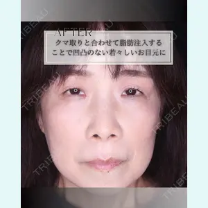 小倉美容外科/美容皮膚科 ビラビューティークリニック 大村 亞蘭医師の症例