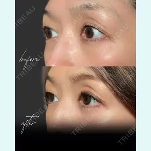 小倉美容外科/美容皮膚科 ビラビューティークリニック 大村 亞蘭医師の症例