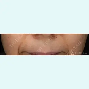 聖心美容クリニック 熱海院 小林 美幸（皮膚科）医師の症例