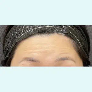 医療法人社団萌隆会　五本木クリニック 海 暁子医師の症例