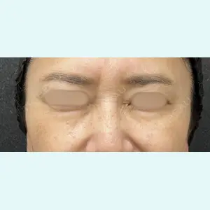 医療法人社団萌隆会　五本木クリニック 海 暁子医師の症例