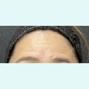 医療法人社団萌隆会　五本木クリニック 海 暁子医師の症例