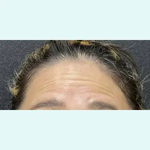 医療法人社団萌隆会　五本木クリニック 海 暁子医師の症例