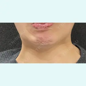 医療法人社団萌隆会　五本木クリニック 海 暁子医師の症例