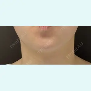 医療法人社団萌隆会　五本木クリニック 海 暁子医師の症例