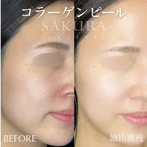 サクラアズクリニック 心斎橋院の症例