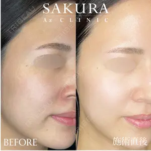 サクラアズクリニック 心斎橋院の症例