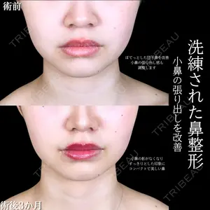 アリエル美容クリニック 大宮院 阪野 一世医師の症例