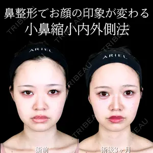 アリエル美容クリニック 大宮院 阪野 一世医師の症例