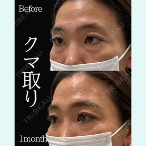 ネビュラクリニック 東京錦糸町院 岩切 琢磨医師の症例