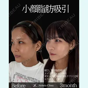 ネビュラクリニック 東京錦糸町院 岩切 琢磨医師の症例