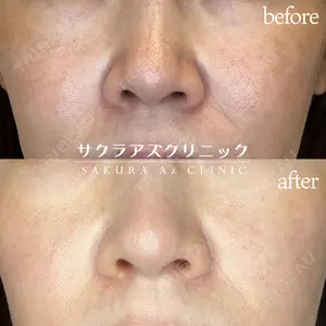 サクラアズクリニック 天神院 伊東 慶子医師の症例