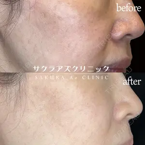 サクラアズクリニック 天神院 伊東 慶子医師の症例
