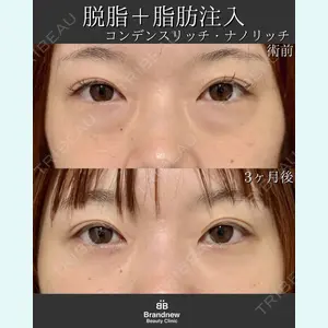 Brandnew Beauty Clinic 平山 容成医師の症例