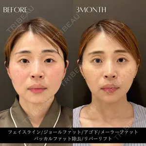 RIVER CLINIC（リバークリニック）の症例