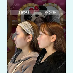 HAAB BEAUTY CLINIC 南青山本院（新院） 金子 雄医師の症例