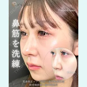 eクリニック 福岡院 伊藤 渉医師の症例