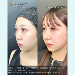 eクリニック 福岡院 伊藤 渉医師の症例