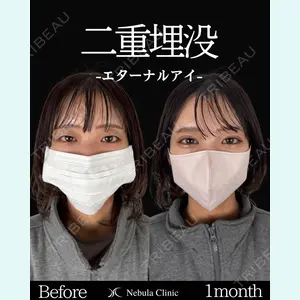 ネビュラクリニック 東京錦糸町院 岩切 琢磨医師の症例