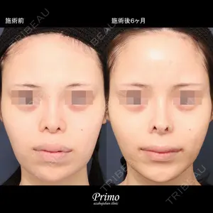 プリモ麻布十番クリニック 大場教弘医師の症例