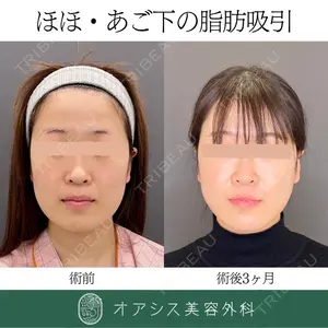 オアシス美容外科 遠藤 剛史医師の症例