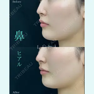 ルラ美容クリニック 町田院 松岡 舟作医師の症例