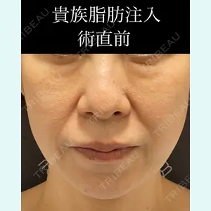 EMMO FACE CLINIC 大宮院 廣松 直樹医師の症例