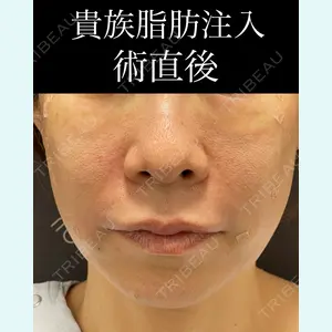 EMMO FACE CLINIC 大宮院 廣松 直樹医師の症例